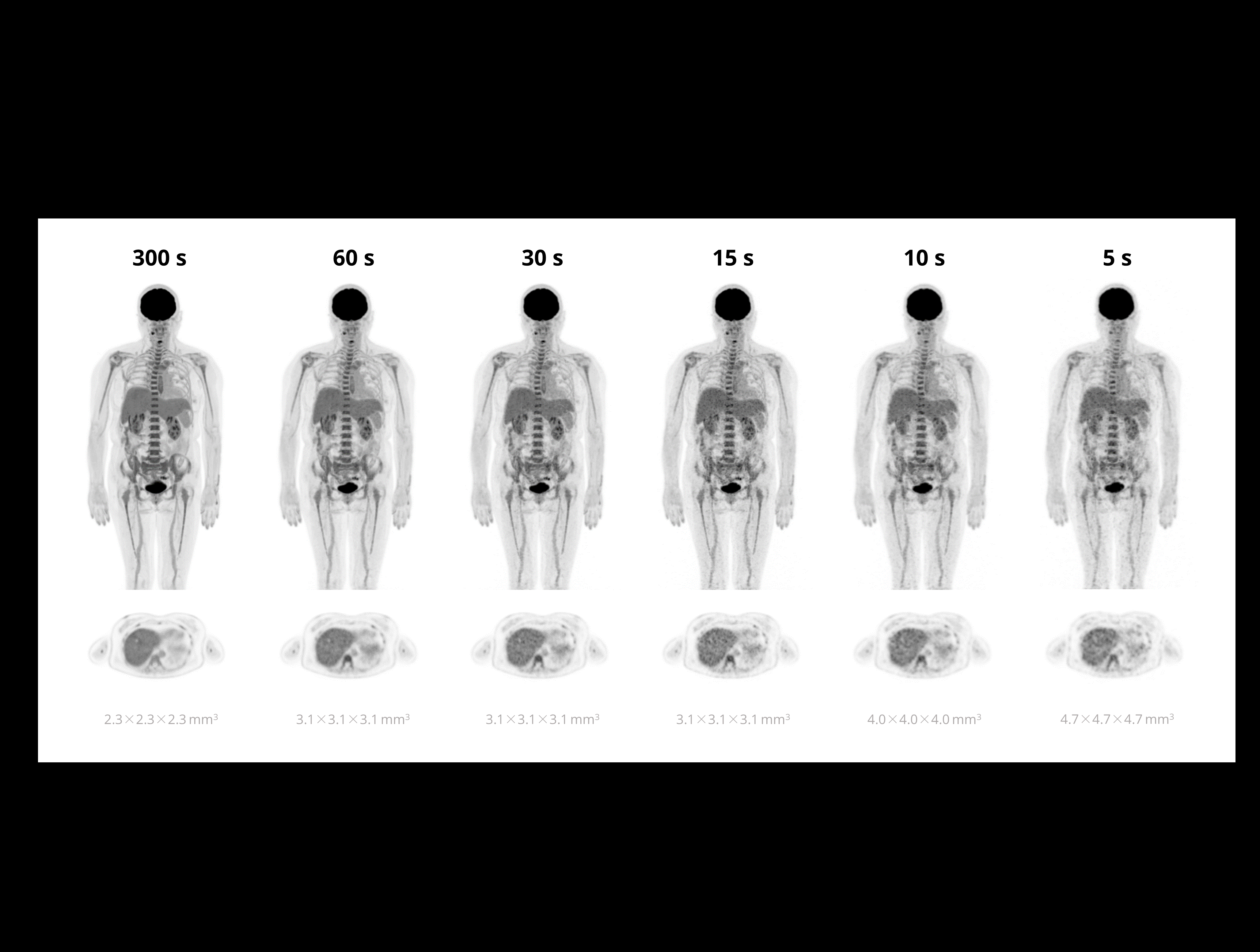 Imagistică whole-body single-bed cu durate variabile de cadre