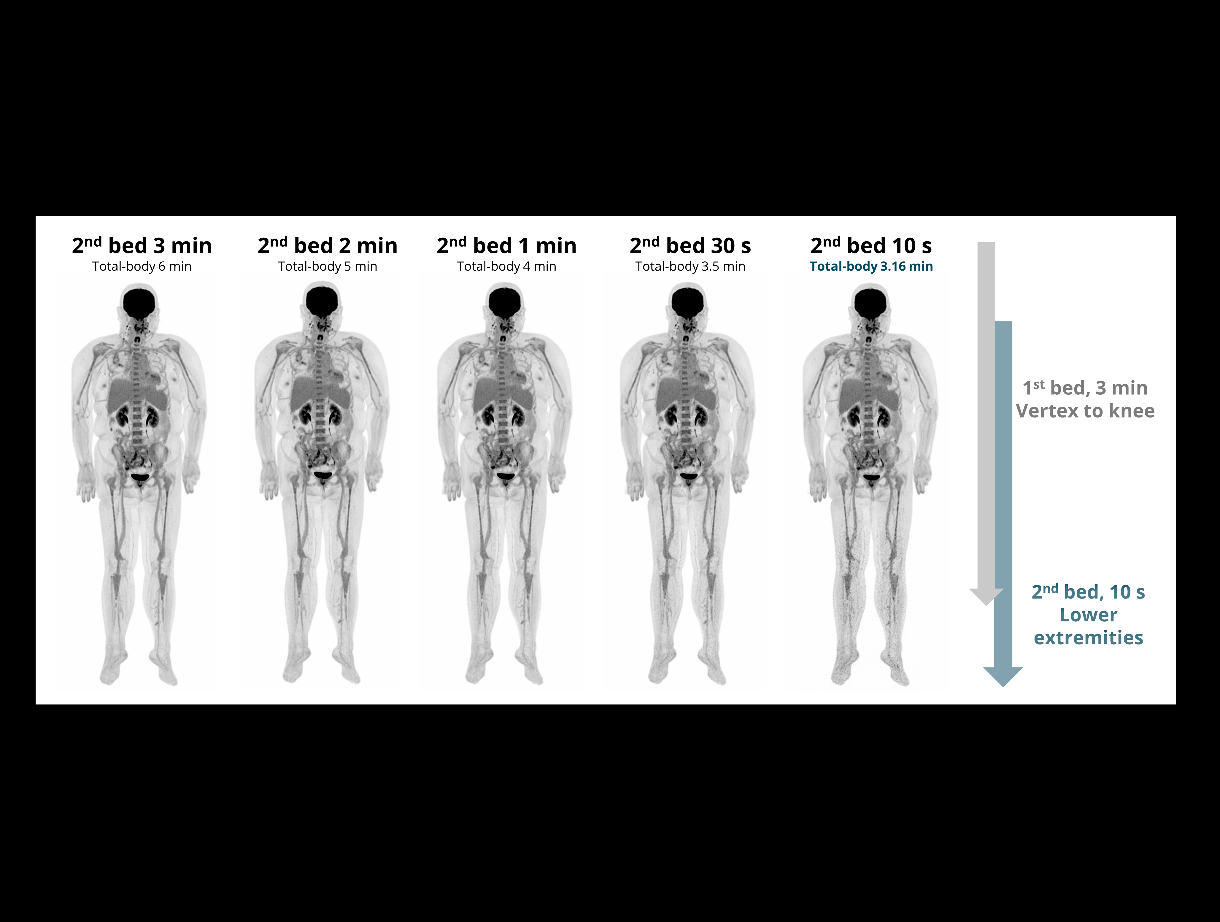 Flux de scanare whole-body flexibil
