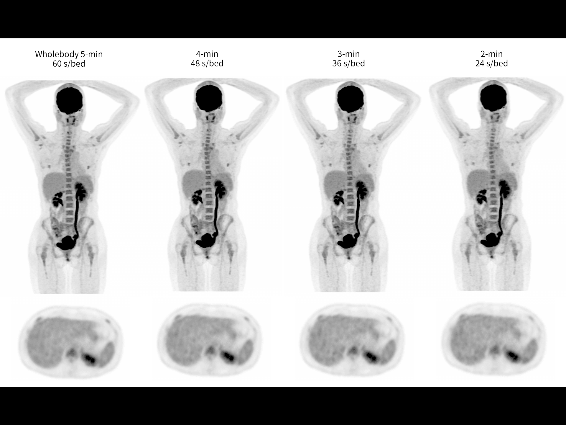 Imagistică whole-body rapidă, în doar 2 minute