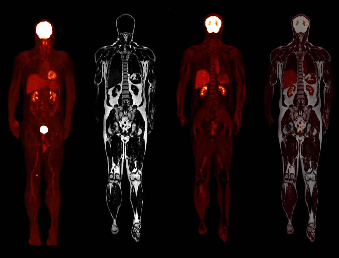 Imagistică whole-body
