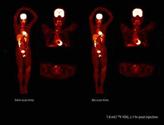Imagistică total-body rapidă