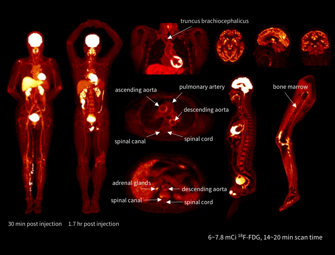 Imagini funcționale cu detalii anatomice