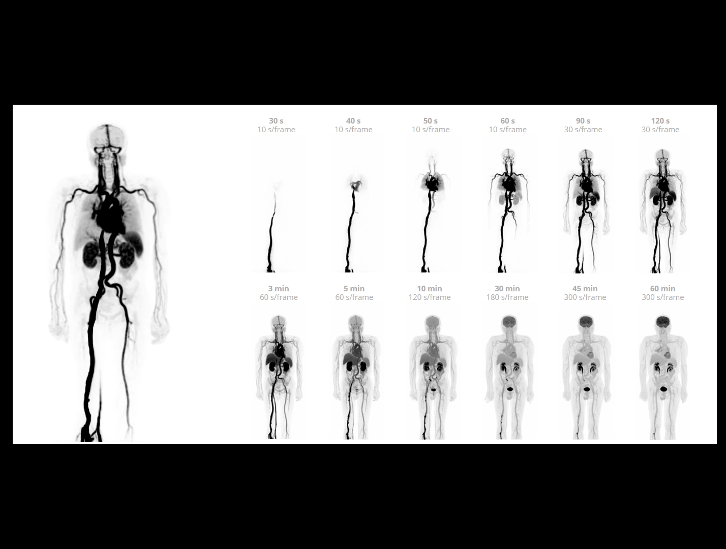 Imagistică dinamică low-dose, de înaltă rezoluție