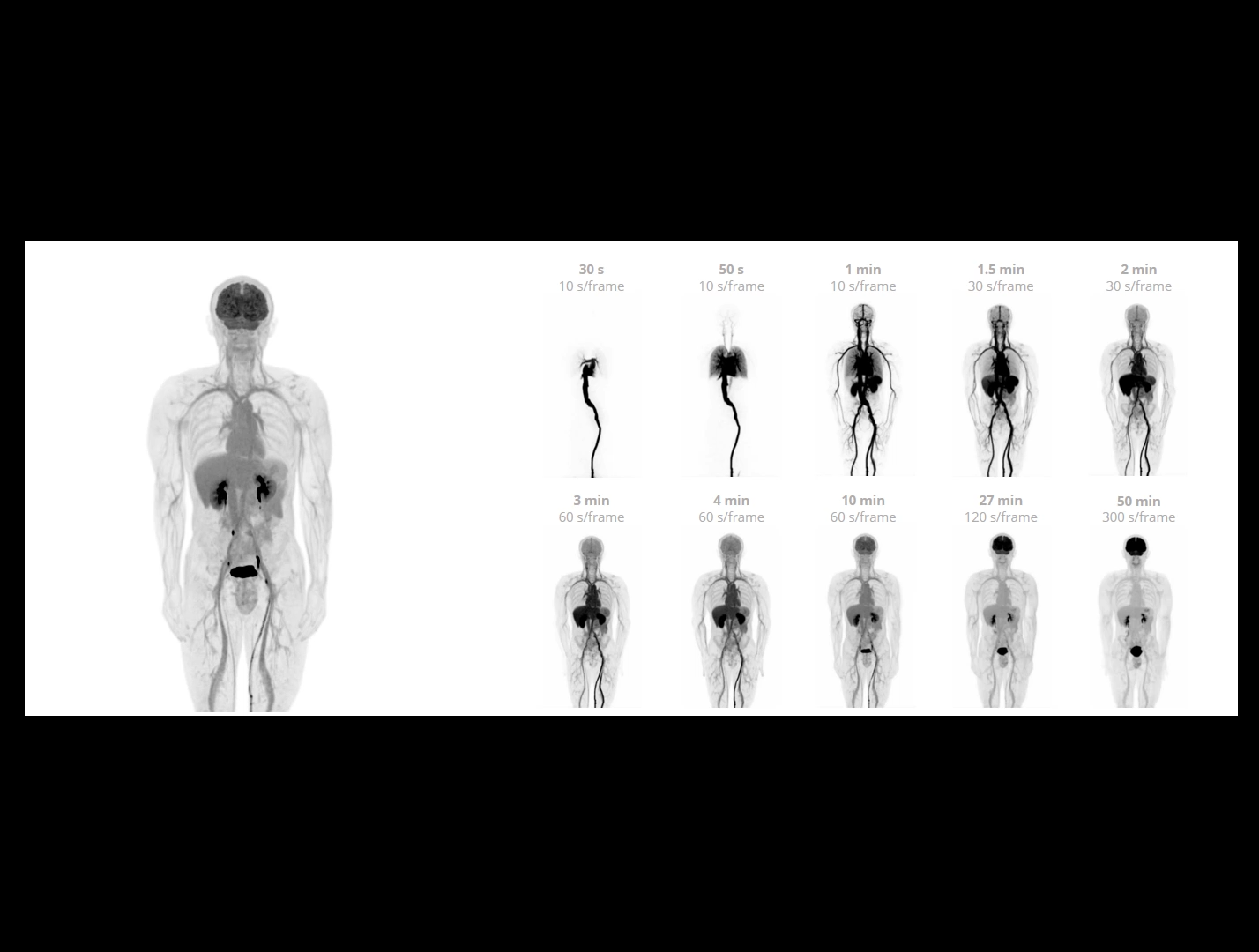 Imagistică dinamică de înaltă rezoluție