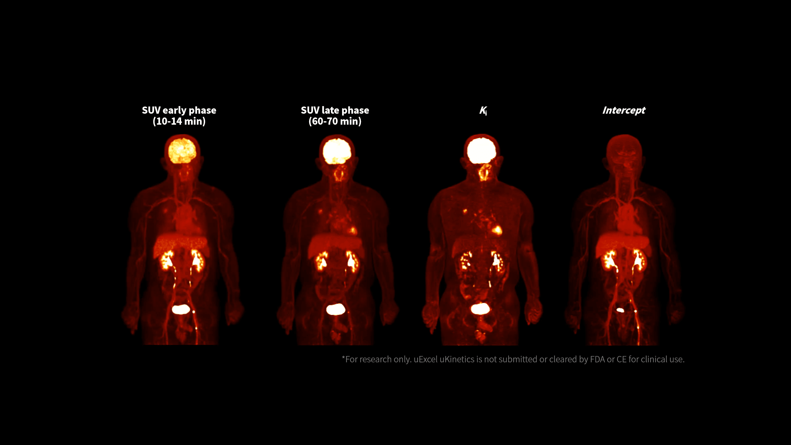 Imagistica KI evidențiază un contrast superior în cancerul pulmonar cu uKinetics