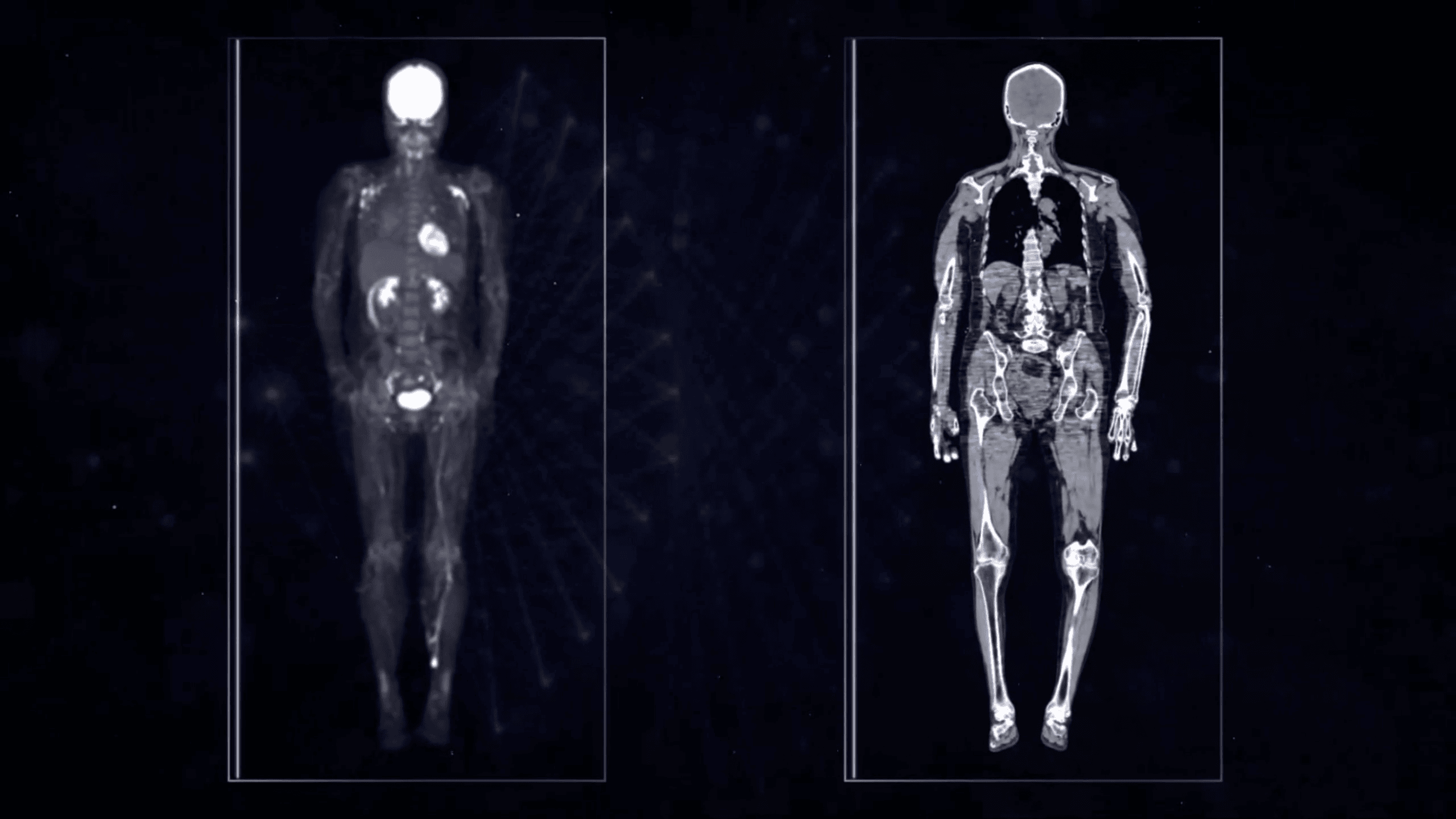 Detector digital cu ghid de lumină integrat
