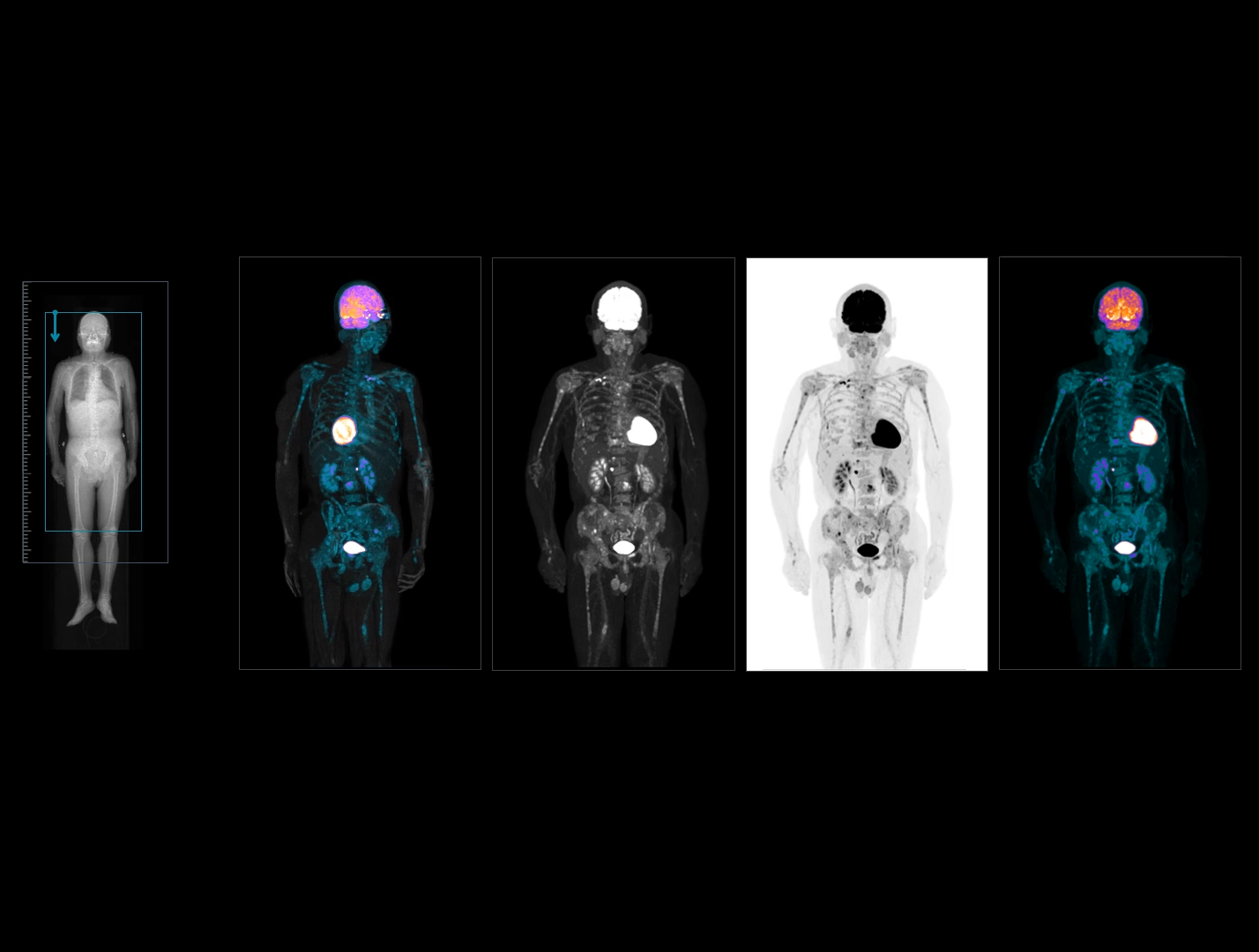 Planificare automată a scanării FOV axiale cu AI