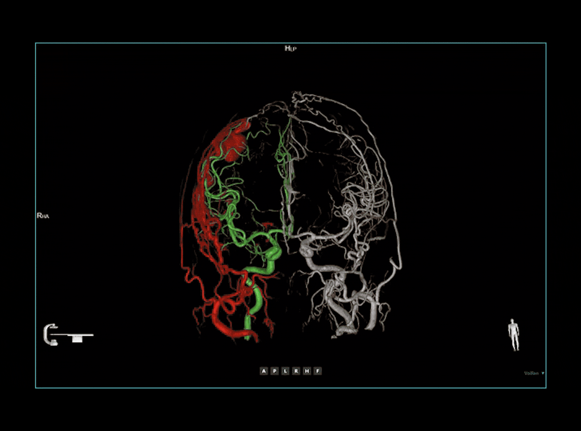 Fuziune multi-modalitate