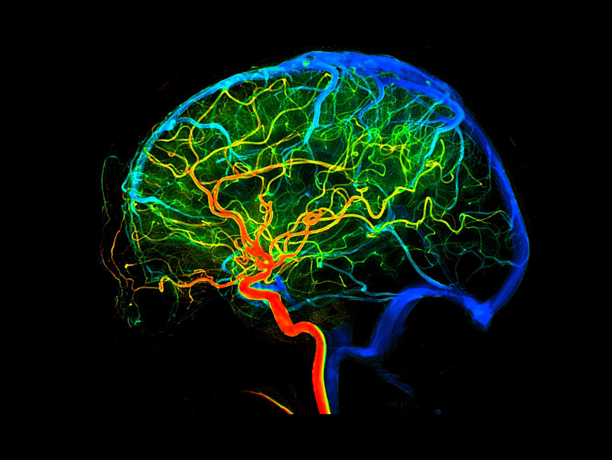 Analiză 2D a fluxului sanguin*