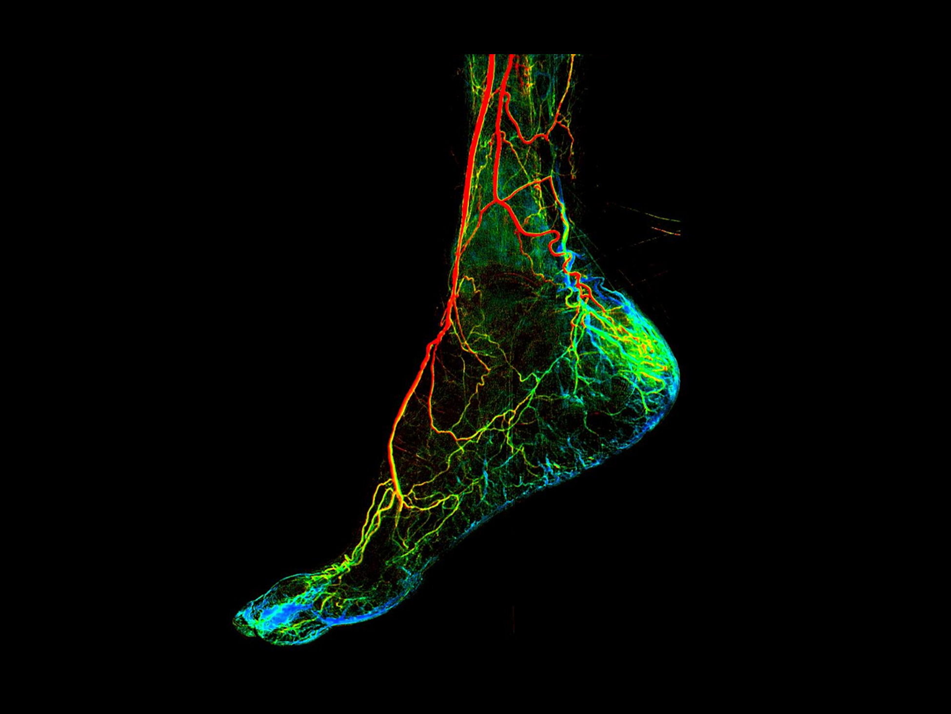 Analiză 2D a fluxului sanguin*