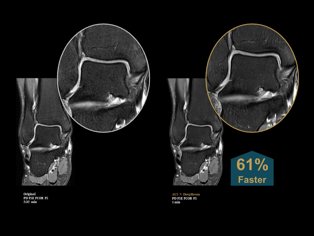 Creșterea vitezei de imagistică